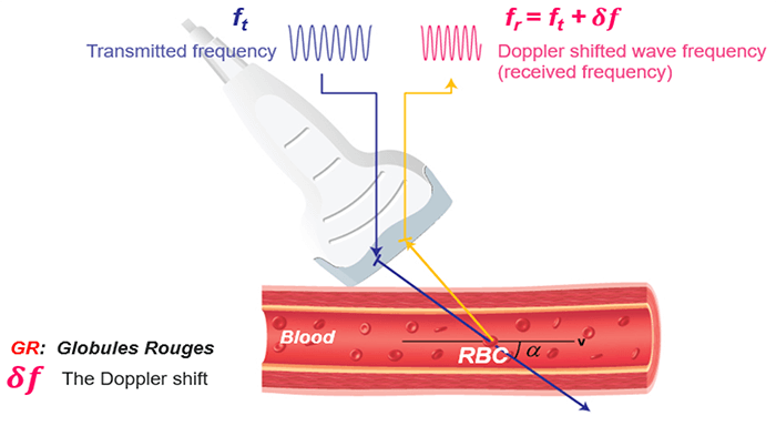 Ultrasound Physics Medical Professionals