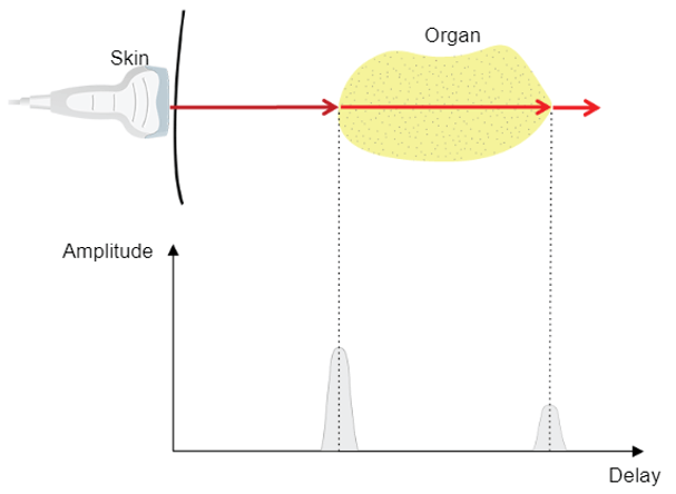 Ultrasound Physics - Medical Professionals