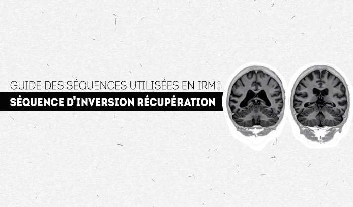 Inversion-Récupération: Guide de séquence en IRM