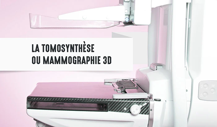 Aperçu sur la Tomosynthèse Mammaire Numérique (TMN)