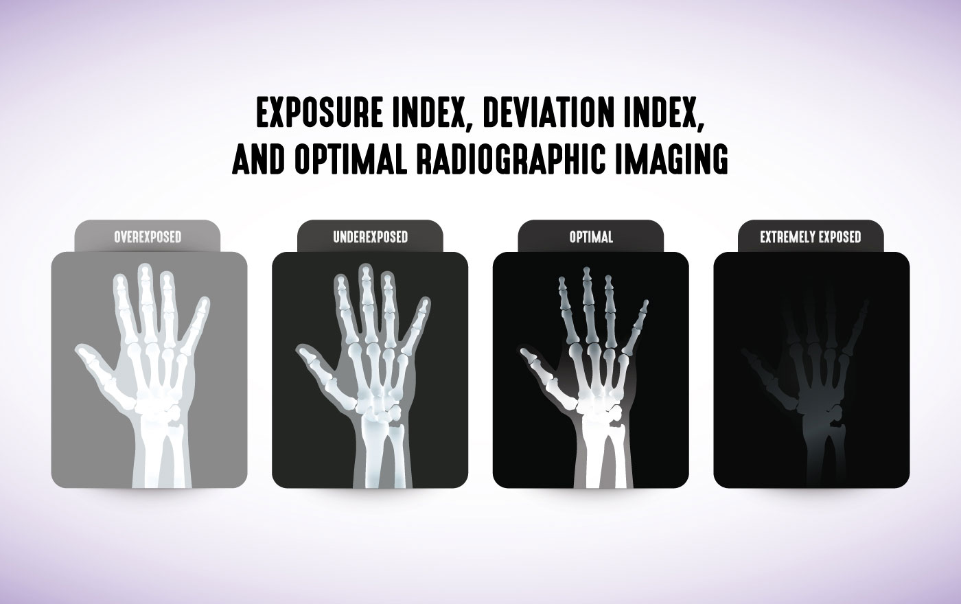 Exposure Deviation Index And Optimal Radiographic Imaging