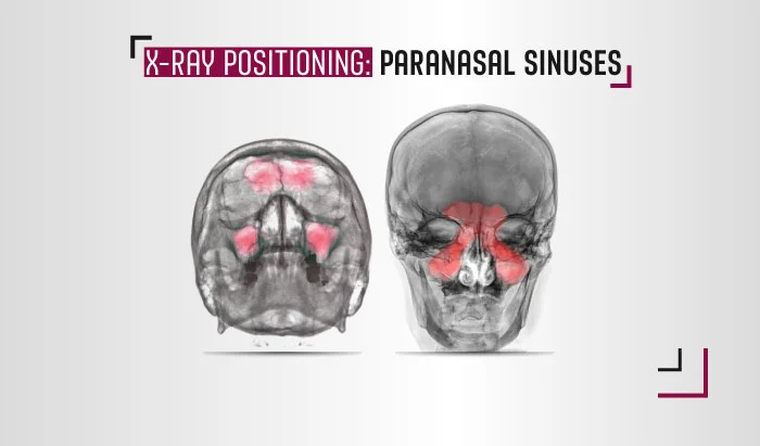 paranasal sinus x-ray views