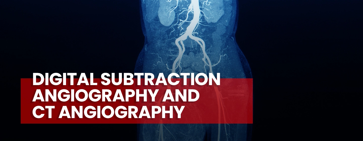 Digital Subtraction Angiography and CT Angiography