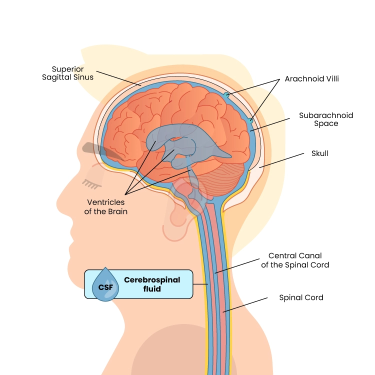 Digital Subtraction Angiography and CT Angiography