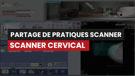 Scanner cervical