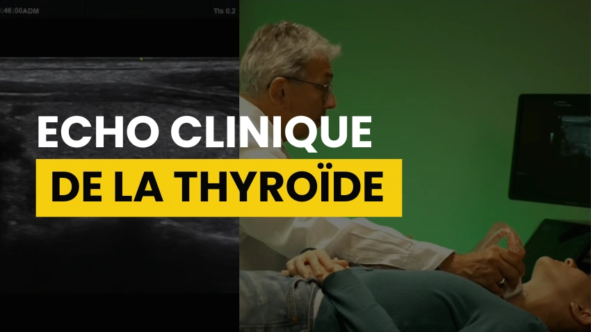 Echographie de la Thyroïde