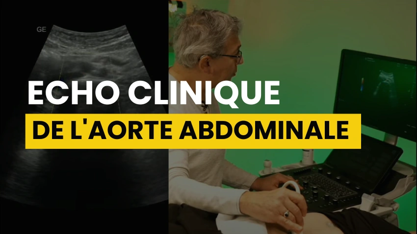 Echographie Clinique de l’Aorte Abdominale