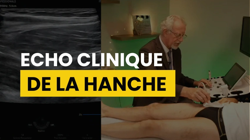 Echographie de la hanche