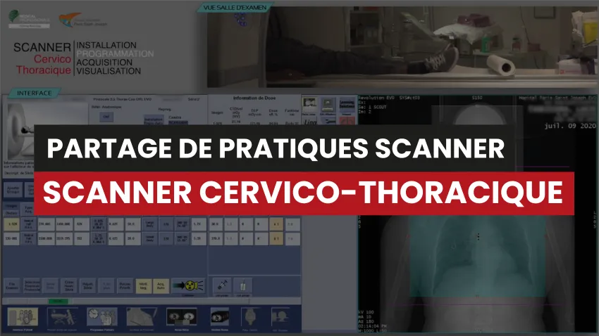 Scanner cervico-thoracique avec injection