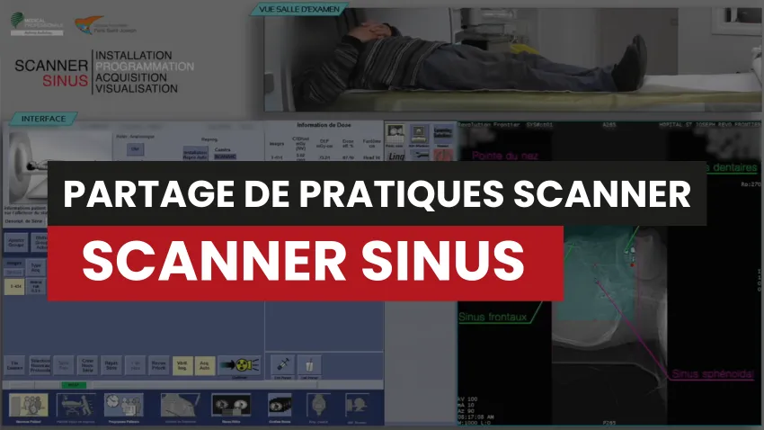 Scanner des sinus