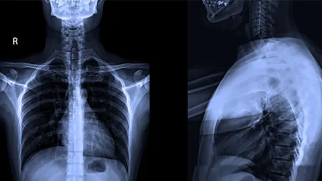 Radiographic Imaging of the Spine CE Course