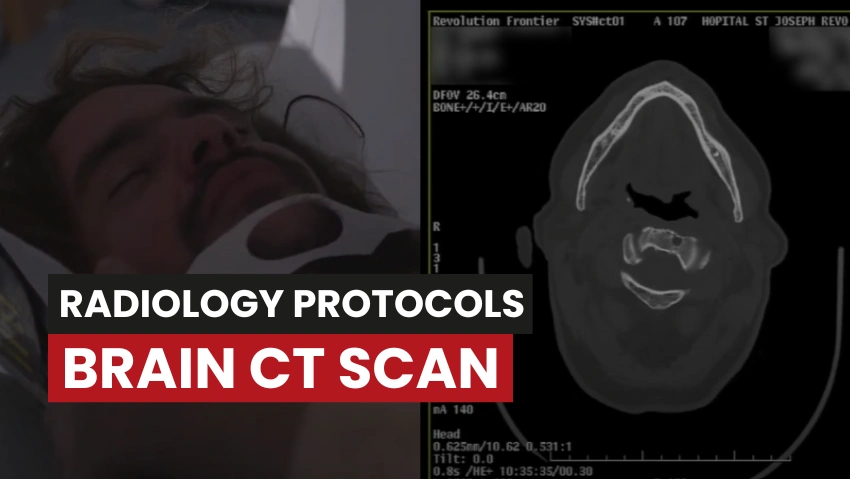 Brain CT Scan with No Contrast