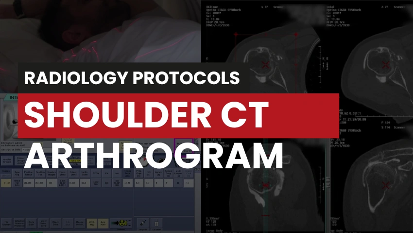 Shoulder CT and Arthrogram