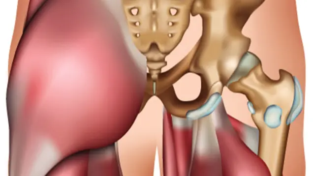 Ultrasound of the Hip