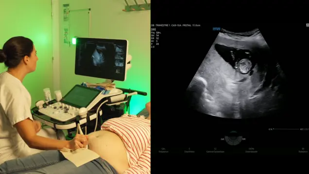 First Trimester Ultrasound CE Course