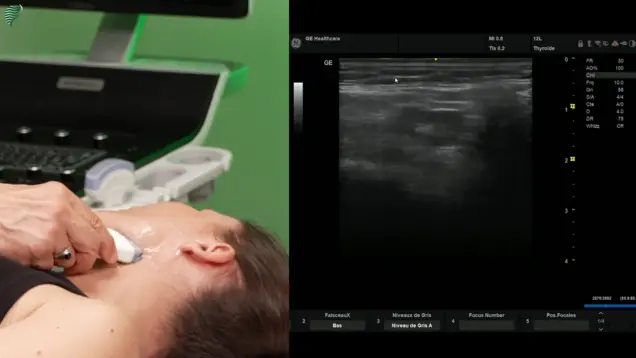 Ultrasound of the Thyroid CE Course