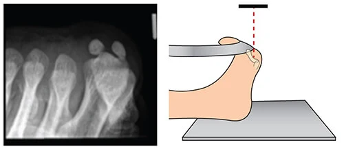 Sesamoid View