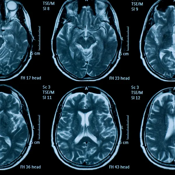 MRI Structured Education Course Combo 6