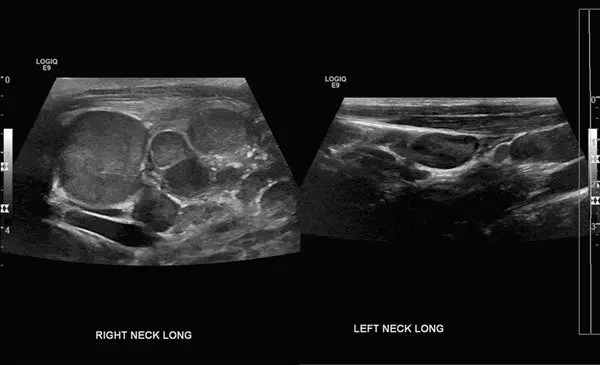 Monkeypox: An Overview and the Role of Radiologic Technologists and Sonographers in the U.S.