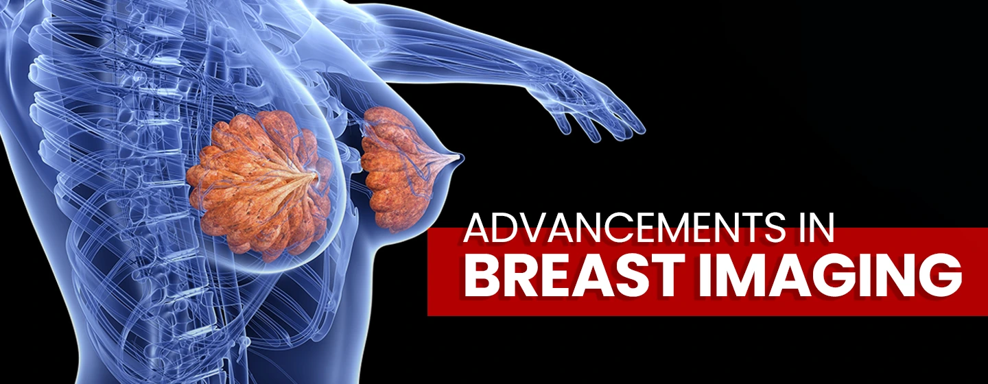 Advancements in Breast Imaging