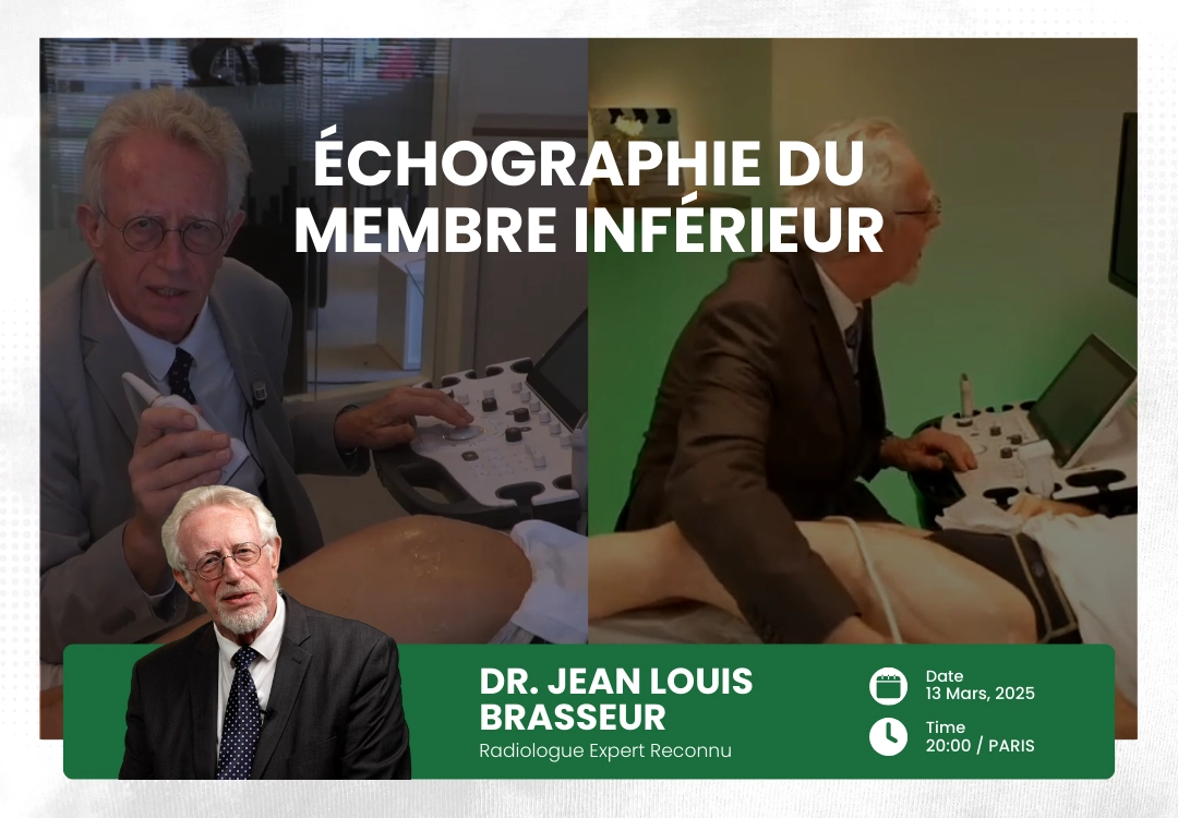 Échographie du membre Inférieur Webinaire