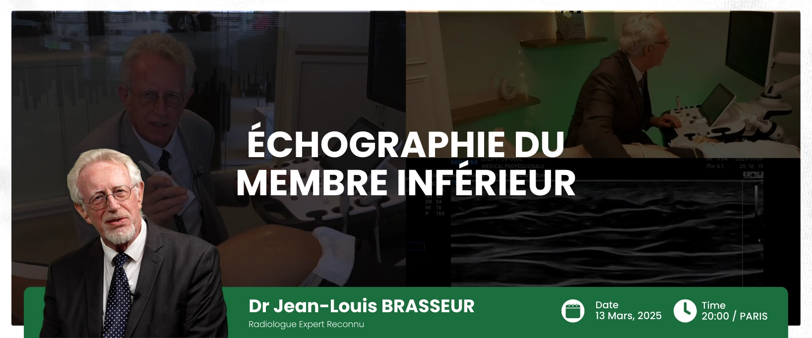 Échographie du membre Inférieur Webinaire