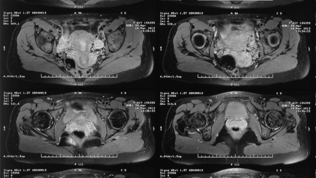 MRI of the Pelvis CE Course