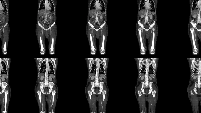 CT Cross Sectional Anatomy of the thorax, abdomen, and pelvis CE / CEU Webinar