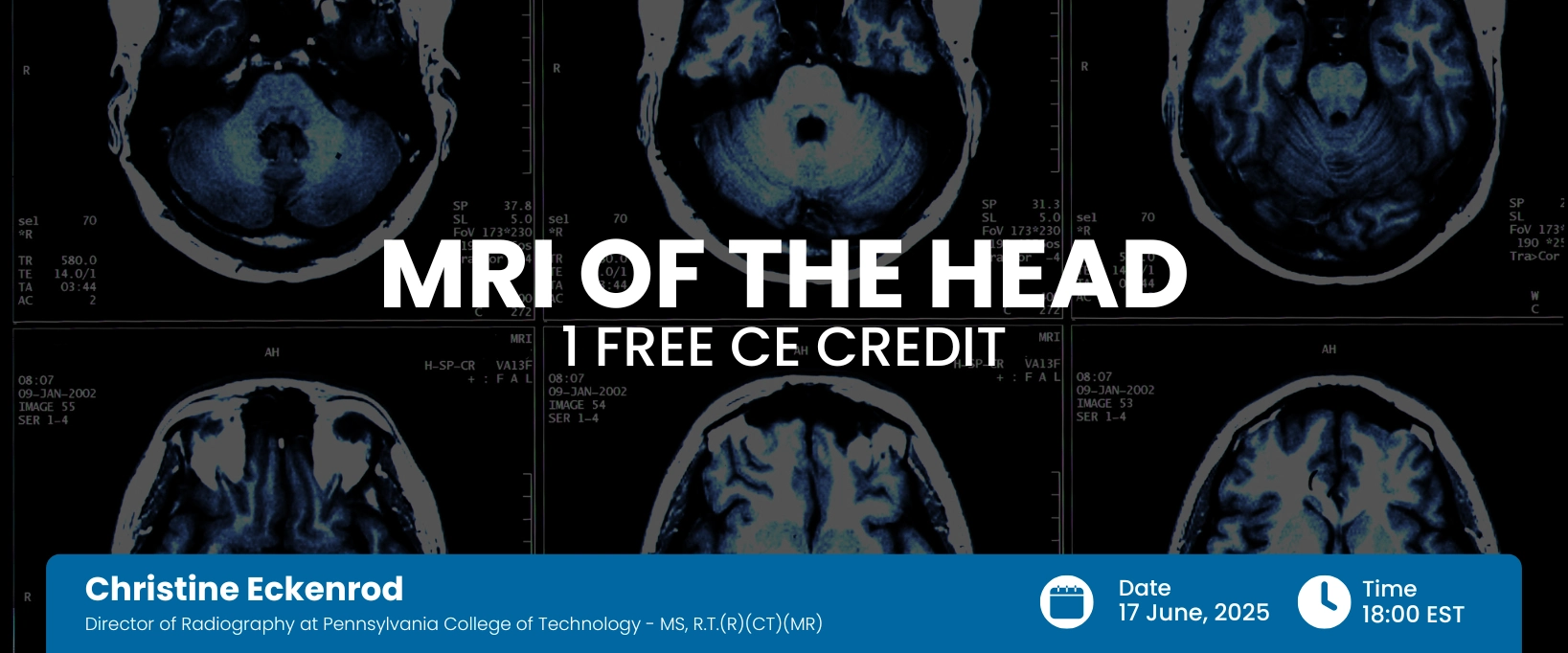 MRI of the Head Webinar