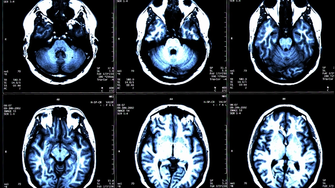 MRI of the Head CE / CEU Webinar