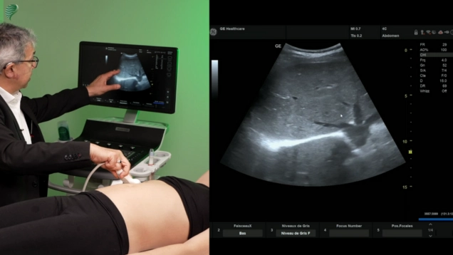 Ultrasound of the Gallbladder CE Course